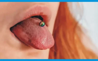 Itching of the Tongue Aftercare Guide